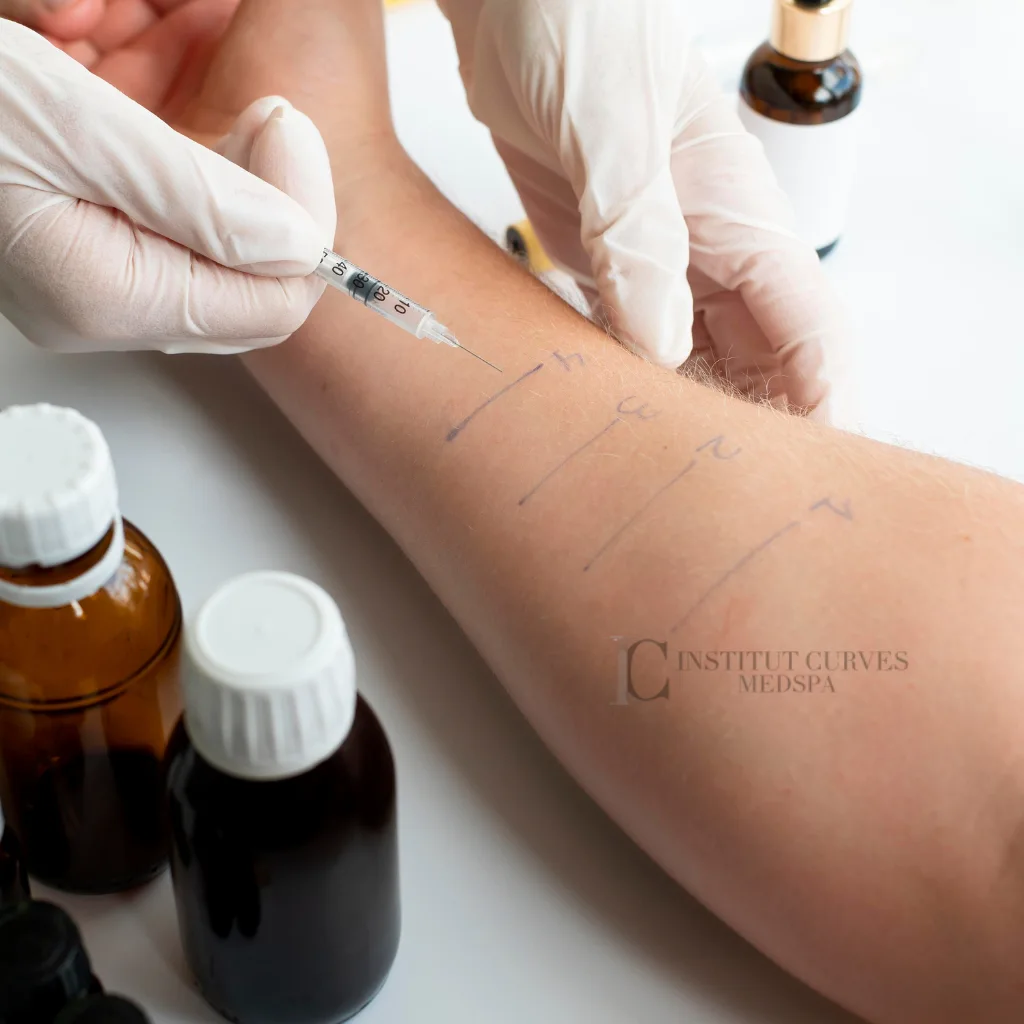 bras injection sclérothérapie Traitement des varices et des varicosités institut curves Mont Sainte-Hilaire