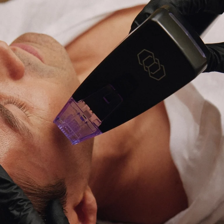 Service MICRONEEDLING ET RADIOFRÉQUENCE